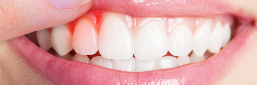 又上火又怕冷？上熱下寒、水火不濟，教你調(diào)回來！