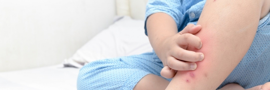 學(xué)古人這樣驅(qū)蚊，從此不再“蚊”風(fēng)喪膽！