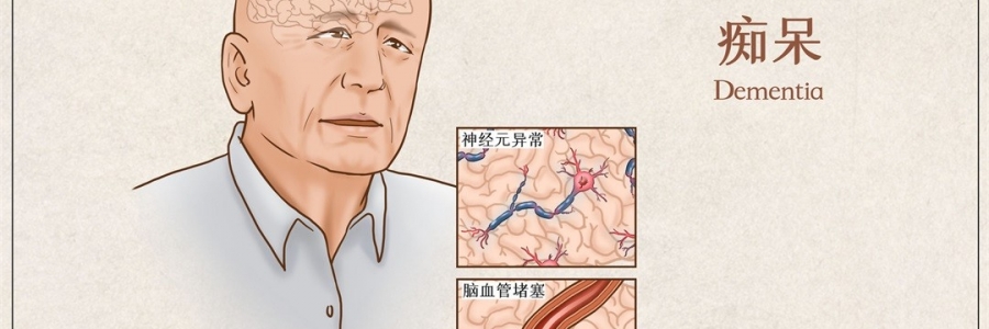 “馬什么梅？”年紀(jì)輕輕老忘事，竟是癡呆的前兆？！