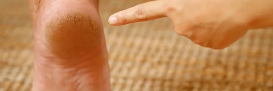 每天跺跺腳，從腳養(yǎng)到頭，越跺越年輕！